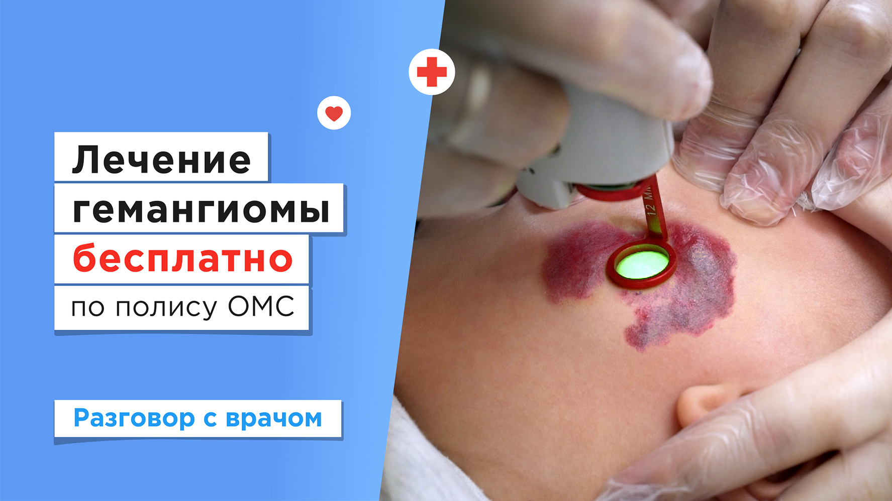 Лазерное удаление гемангиомы у детей бесплатно по полису ОМС смотреть онлайн