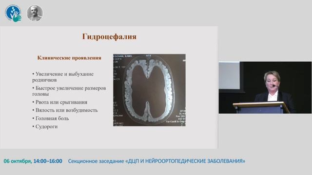 Основные неврологические изменения у детей со Spina bifida. смотреть онлайн