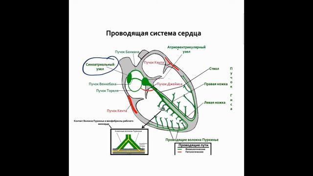 блокада правой и левой ножки пучка гиса | лучшая книга про ЭКГ смотреть онлайн