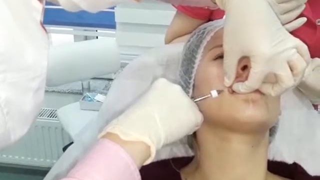 Постановка руки. Д-р. Зарина Багирова смотреть онлайн