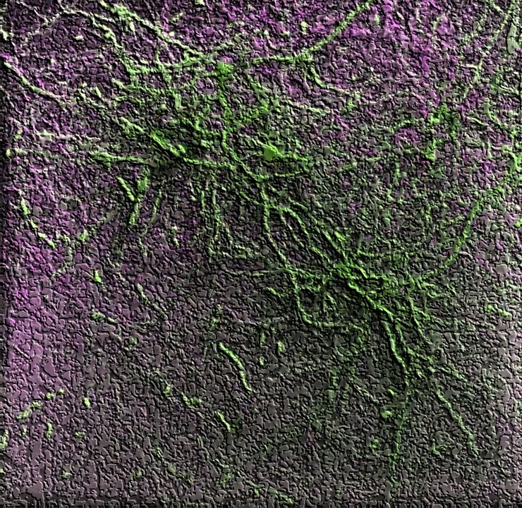 Как выглядит мозг под микроскопом? // Нейроны и синапсы