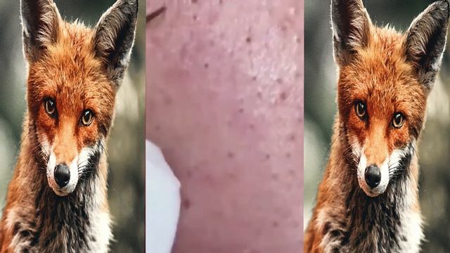 Best Pimples Popping Blackheads || 30/04/2021 #2 смотреть онлайн
