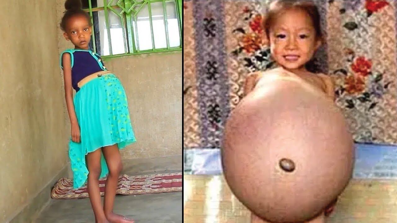 Эти Случаи Беременности Побили Все Рекорды смотреть онлайн