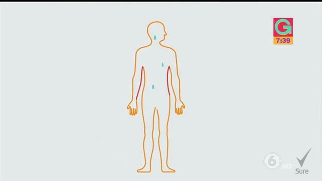 Aprenda a distinguir cuándo el sudor nocturno puede convertirse en un problema | Salud смотреть онлайн