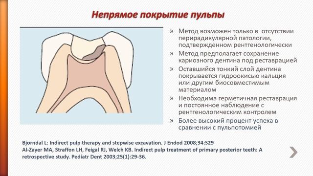 Пульпит временных зубов у детей смотреть онлайн