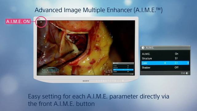 Sony LMD-X3200MD 4K Medical Monitor - Ease of Use Features Video смотреть онлайн