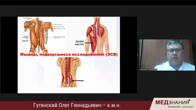ВОЗМОЖНОСТИ ОБЪЕКТИВНОЙ ДИАГНОСТИКИ И РЕЗУЛЬТАТИВНОЙ ТЕРАПИИ МЫШЕЧНО-ТОНИЧЕСКОГО СИНДРОМА смотреть онлайн