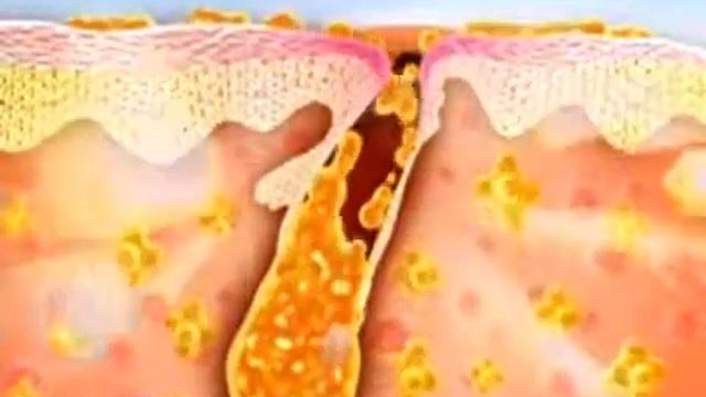 Демодекс Ру самый большой ассортимент средств от демодекоза www demodex ru смотреть онлайн