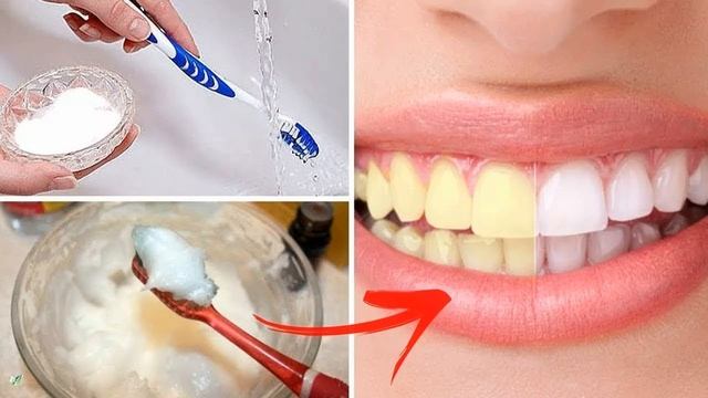 Как отбелить зубы в домашних условиях смотреть онлайн