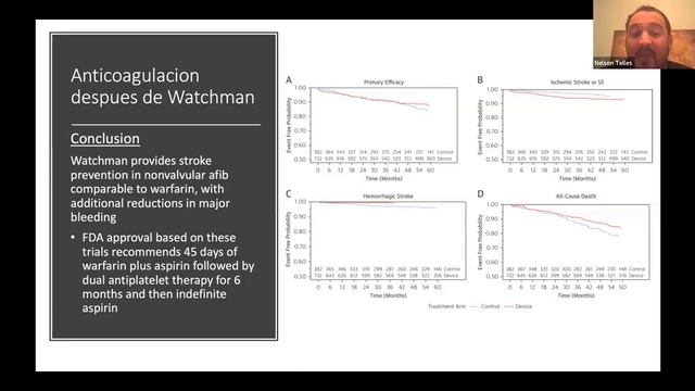 Webinar FAC - Oclusión de Orejuela смотреть онлайн