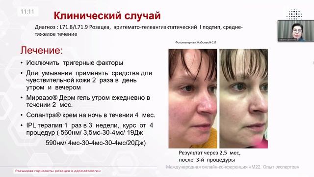 Секреты Здоровой Кожи