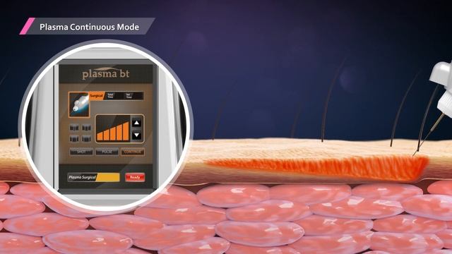 Plasma BT Introduction смотреть онлайн