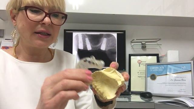 Цифровое планирование зубных имплантов - клиника Др. Риммы Глузман