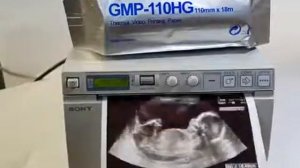 AK ULTRA IMAGING SYSTEM - SONY UP-D897 Thermal Printer - Demo - SONY UP-D897 SPECIFICATIONS