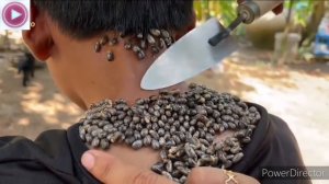 Устранение сотен клещей в человеческом теле