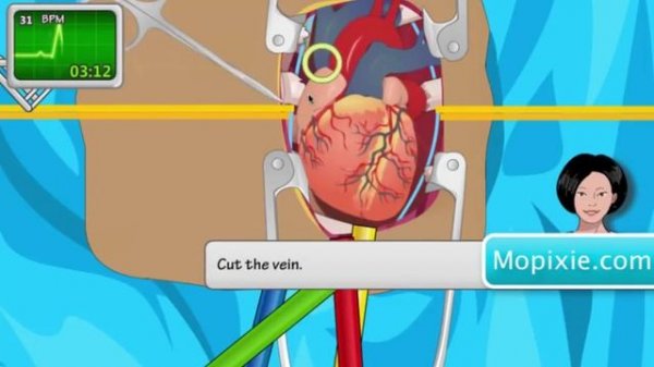 OPERATE NOW : HEART SURGERY | PLAY SURGERY GAMES
