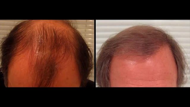 Как сделать маску из лука для волос смотреть онлайн