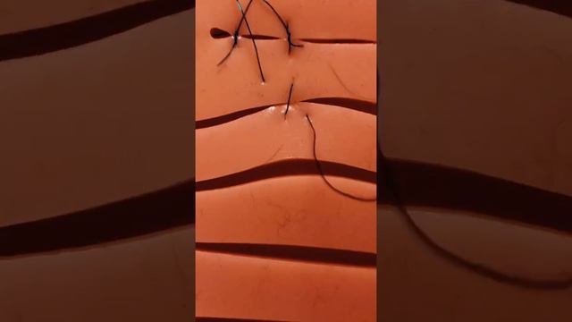 Z образный шов смотреть онлайн