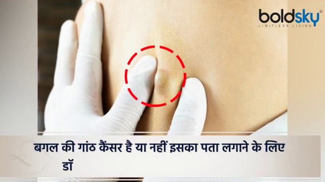 कांख में गांठ कैंसर है या नहीं | Under Arms Lump Cancer है या नहीं Doctors Advice | Boldsky смотреть онлайн