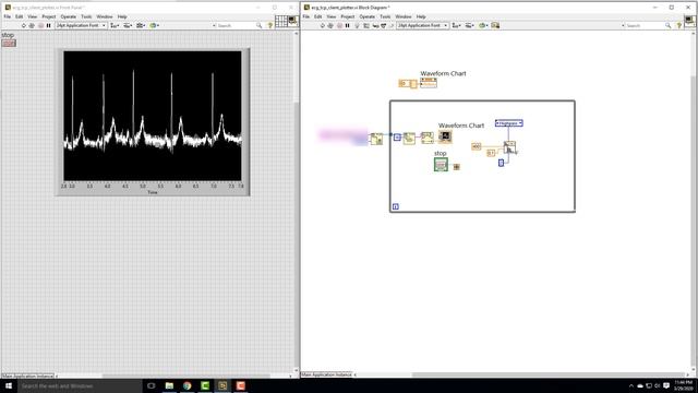 BME 214L Real-time filtering of streaming ECG data using LabVIEW смотреть онлайн