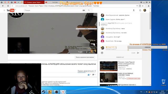 Поехали стрим Парни CSGo )) болезнь АЛАПЕЦИЯ облысение всего тела!! хочу вылечиться((( смотреть онлайн