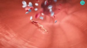 ТИПЫ КАМНЕЙ В ПОЧКАХ И СПОСОБЫ ИХ ЛЕЧЕНИЯ