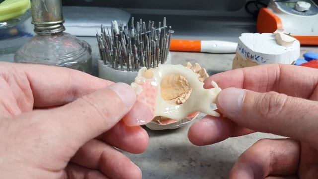 №21 - Ацеталовый протез с ацеталовым зубом смотреть онлайн