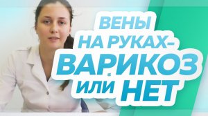 Вены на руках, варикозная болезнь на руках – есть она или нет? Флебологический центр «Антирефлюкс»