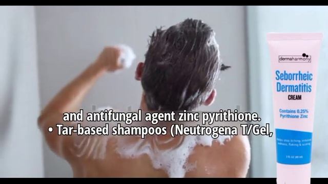 How can I remove dandruff from my scalp? смотреть онлайн