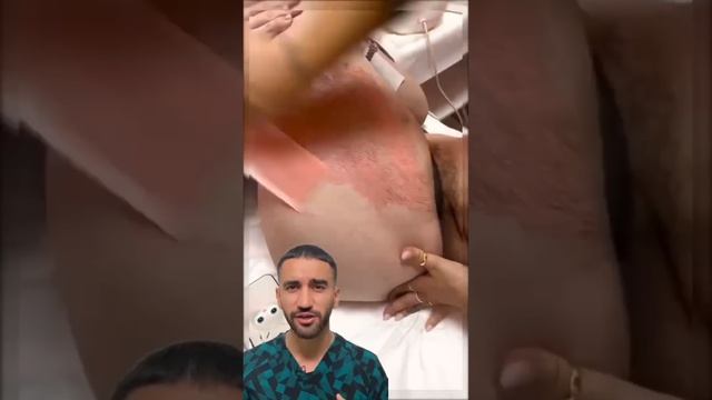 восковая эпиляция будет не больно смотреть онлайн