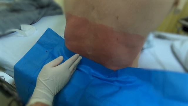 Spinal Tap - Anesthesia: Paramedian Technique - Crash course with Dr. Hadzic смотреть онлайн