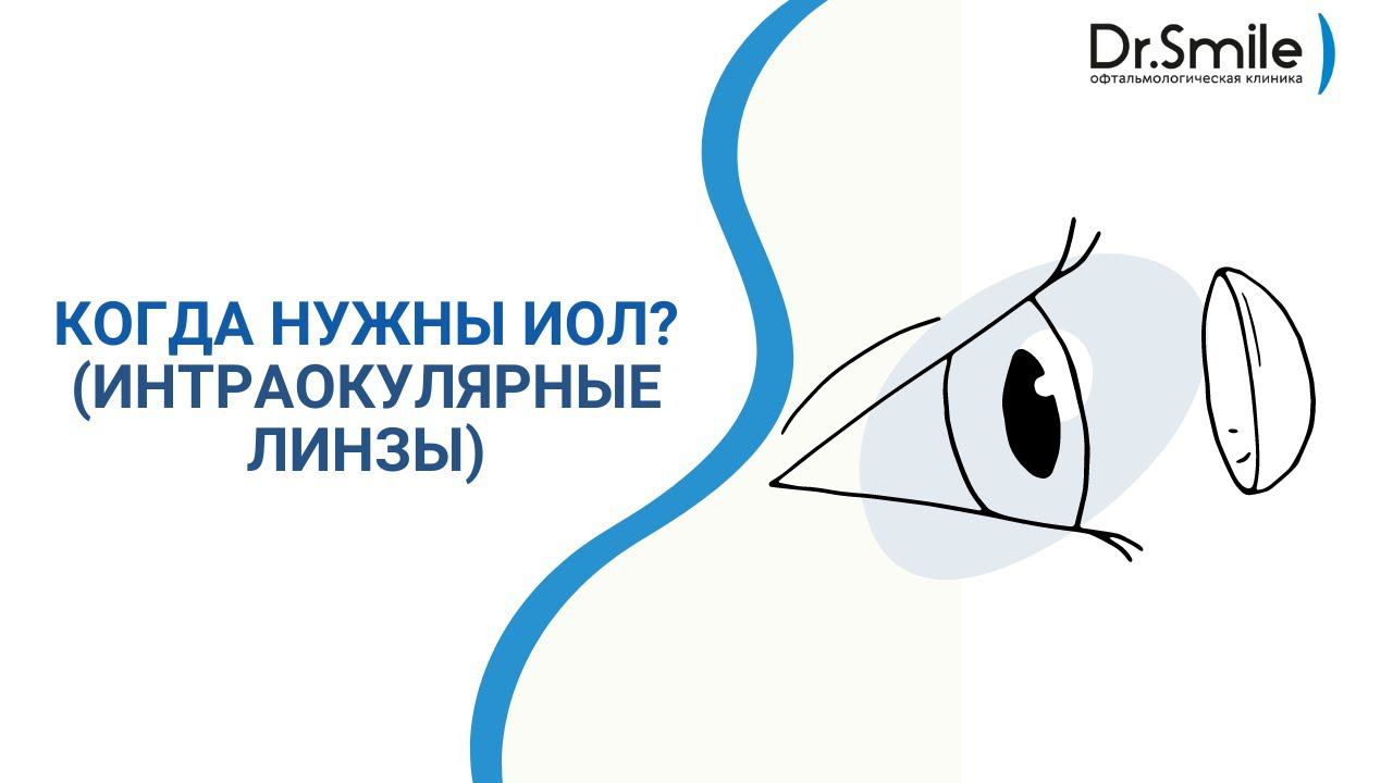 Когда нужны ИОЛ | Интраокулярные линзы смотреть онлайн