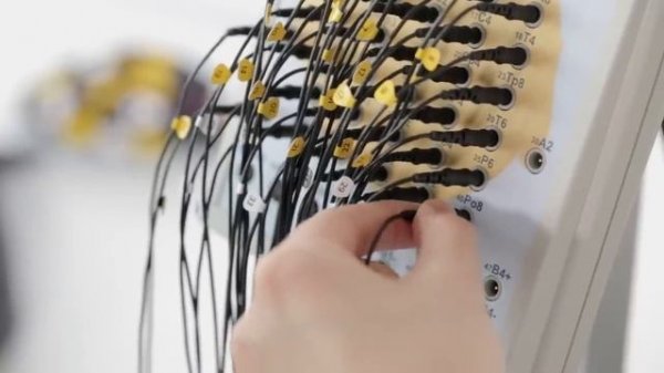 EEG system example of work (NVX, NeoREC, MCScap)