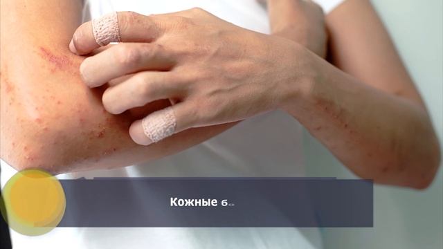 Дегтярное мыло: польза дегтярного мыла для кожи и волос смотреть онлайн