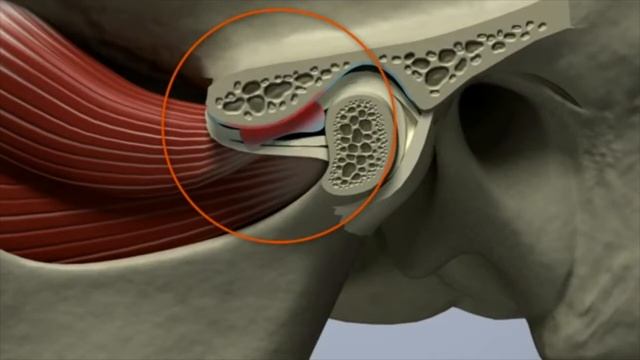Внчс дислокация