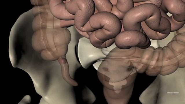 Аппендицит. Как и почему он появляется смотреть онлайн