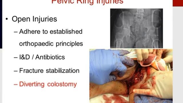 MILLER'S 2016 Orthopaedics: Trauma. Pelvis and Upper Extremity смотреть онлайн