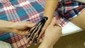 Тейпирование постинсультных больных для профилактики контрактур