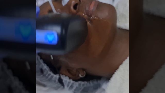 Laser Hair Removal with the Soprano Titanium смотреть онлайн