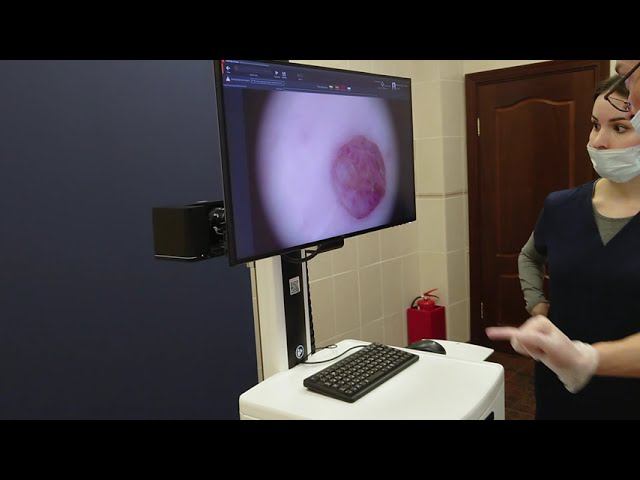 Картирование кожи на FotoFinder - паспорт кожи смотреть онлайн