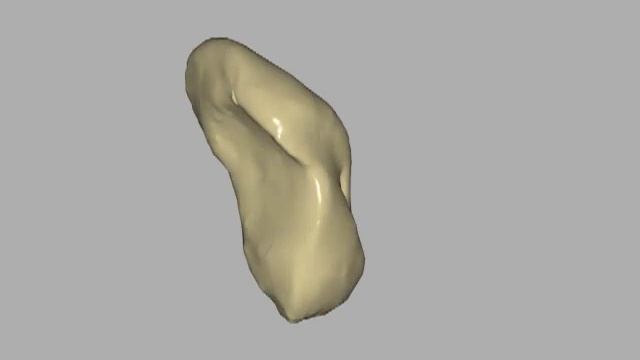 Vue 3D du scaphoïde carpien смотреть онлайн