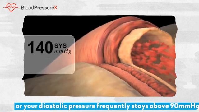 BloodPressureX REVIEW 2020 | IGADGET24 | Best Blood Pressure Monitor 2020 | 50% Off ?? смотреть онлайн