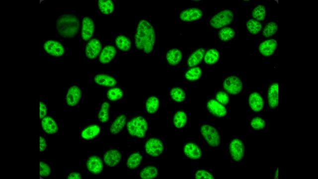 Toxoplasmosis (Toxoplasma gondii) смотреть онлайн
