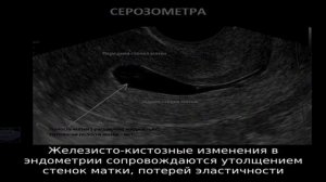 Эндометрит у собаки