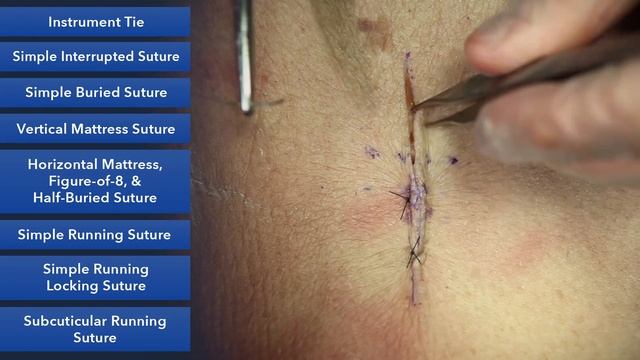 Learn How To Suture - Best Suture Techniques and Training смотреть онлайн