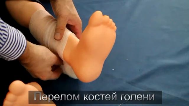 Обучение навыкам наложения повязок и шин при переломе костей голени смотреть онлайн