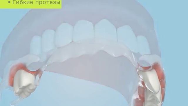 Школа здоровья. Гибкие протезы смотреть онлайн