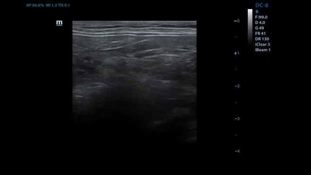 множественные кисты поджелудочной железы у кошек. смотреть онлайн