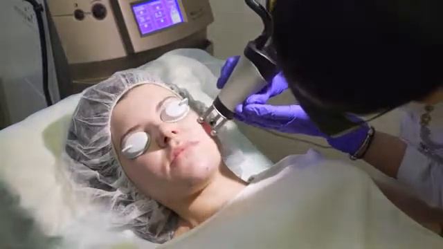 Лазерная шлифовка смотреть онлайн