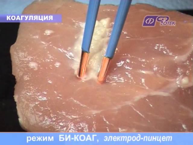 Демонстрация режима: "БиКоаг" смотреть онлайн